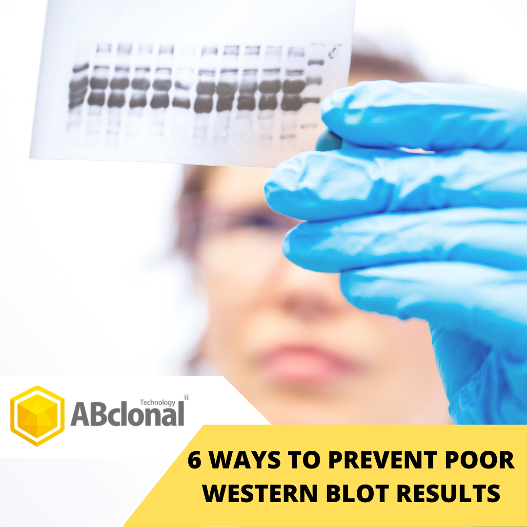 6 Ways to Prevent Poor Western Blot Results