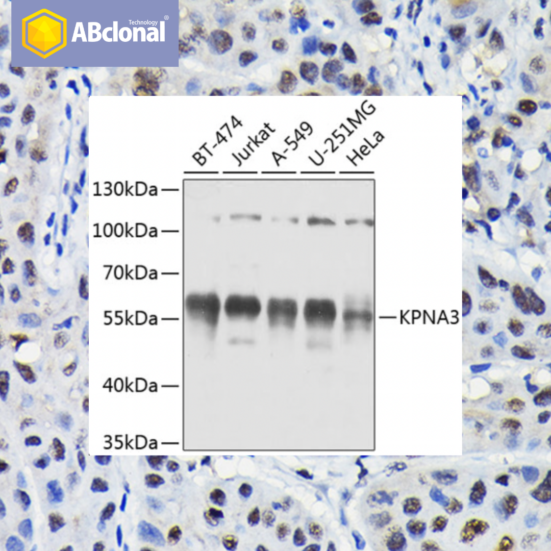NIH Antibody 4